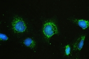 IF/ICC staining of FFPE human U-2 OS cells with HAS1 antibody (green) at 2ug/ml and DAPI nuclear stain (blue). HIER: steam section in pH6 citrate buffer for 20 min.