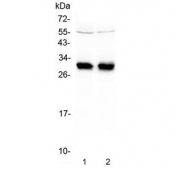 Western blot testing of two lots of human Raji lysate with HLA-DRB1 antibody at 0.5ug/ml. Predicted molecular weight ~30 kDa.