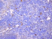 IHC staining of FFPE mouse spleen with CD229 antibody at 1ug/ml. HIER: boil tissue sections in pH6, 10mM citrate buffer, for 10-20 min followed by cooling at RT for 20 min.