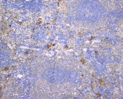 IHC staining of FFPE rat spleen with CD229 antibody at 1ug/ml. HIER: boil tissue sections in pH6, 10mM citrate buffer, for 10-20 min followed by cooling at RT for 20 min.