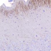 IHC staining of FFPE mouse brain with MOG antibody at 1ug/ml. HIER: boil tissue sections in pH6, 10mM citrate buffer, for 10-20 min followed by cooling at RT for 20 min.