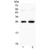 Western blot testing of 1) rat brain and 2) mouse brain lysate with MOG antibody at 0.5ug/ml. Expected molecular weight: 15-28 kDa depending on glycosylation level.