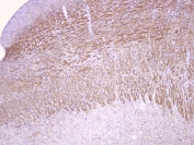 IHC staining of FFPE rat brain with MOG antibody at 1ug/ml. HIER: boil tissue sections in pH6, 10mM citrate buffer, for 10-20 min followed by cooling at RT for 20 min.