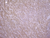 IHC staining of FFPE rat brain with MOG antibody at 1ug/ml. HIER: boil tissue sections in pH6, 10mM citrate buffer, for 10-20 min followed by cooling at RT for 20 min.