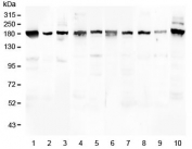 Western blot testing of 1) human placenta 2) human U-2 OS, 3) human HeLa, 4) rat brain, 5) rat lung, 6) mouse brain, 7) mouse lung, 8) mouse kidney, 9) mouse spleen and 10) mouse Neuro-2a lysate with PCDH15 antibody at 0.5ug/ml. Isoforms have been observed with molecular weights of: 250, 180, 160, 130, 90 and 60 kDa.