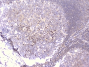 IHC staining of FFPE human tonsil with PCDH15 antibody at 1ug/ml. HIER: boil tissue sections in pH6, 10mM citrate buffer, for 10-20 min followed by cooling at RT for 20 min.