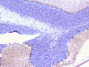 IHC staining of FFPE mouse brain with PCDH15 antibody at 1ug/ml. HIER: boil tissue sections in pH6, 10mM citrate buffer, for 10-20 min followed by cooling at RT for 20 min.