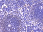 IHC staining of FFPE mouse spleen with PCDH15 antibody at 1ug/ml. HIER: boil tissue sections in pH6, 10mM citrate buffer, for 10-20 min followed by cooling at RT for 20 min.