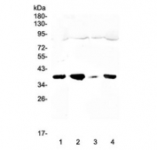 Western blot testing of 1) rat testis, 2) mouse small intestine, 3) mouse kidney and 4) mouse testis lysate with uPAR antibody at 0.5ug/ml. Expected molecular weight: 37-60 kDa, depending on glycosylation level.