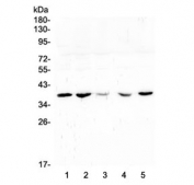 Western blot testing of human 1) placenta, 2) U-2 OS, 3) A431, 4) HeLa and 5) A549 lysate with uPAR antibody at 0.5ug/ml. Expected molecular weight: 37-60 kDa, depending on glycosylation level.