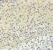 IHC staining of FFPE mouse brain tissue with PKC beta antibody. HIER: boil tissue sections in pH8 EDTA for 20 min and allow to cool before testing.
