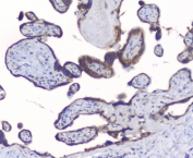 IHC staining of FFPE human placenta with PKC beta antibody at 1ug/ml. HIER: boil tissue sections in pH6, 10mM citrate buffer, for 10-20 min followed by cooling at RT for 20 min.