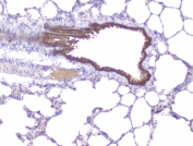 IHC staining of FFPE rat lung with PKC beta antibody at 1ug/ml. HIER: boil tissue sections in pH6, 10mM citrate buffer, for 10-20 min followed by cooling at RT for 20 min.