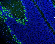 Immunofluorescent staining of FFPE rat cerebellum tissue with PKC gamma antibody (green) and DAPI nuclear stain (blue). HIER: steam section in pH8 EDTA buffer for 20 min.