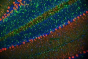 Immunofluorescent staining of FFPE rat cerebellum tissue with PKC gamma antibody (red), GFAP antibody (green) and DAPI nuclear stain (blue). HIER: steam section in pH8 EDTA buffer for 20 min.