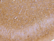 IHC staining of FFPE mouse brain with PKC gamma antibody at 1ug/ml. HIER: boil tissue sections in pH8 EDTA for 10-20 min followed by cooling at RT for 20 min.