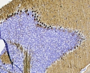 IHC staining of FFPE mouse cerebellum with PKC gamma antibody at 1ug/ml. HIER: boil tissue sections in pH8 EDTA for 10-20 min followed by cooling at RT for 20 min.