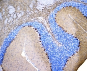 IHC staining of FFPE rat brain with PKC gamma antibody at 1ug/ml. HIER: boil tissue sections in pH8 EDTA for 10-20 min followed by cooling at RT for 20 min.