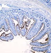 IHC staining of FFPE rat intestine with Sucrase Isomaltase antibody at 1ug/ml. HIER: boil tissue sections in pH6, 10mM citrate buffer, for 10-20 min followed by cooling at RT for 20 min.