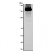 Western blot testing of rat intestine lysate with Sucrase Isomaltase antibody. Predicted molecular weight ~209 kDa.