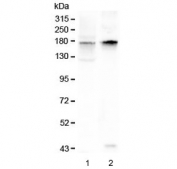 Western blot testing of 1) rat brain and 2) mouse brain lysate with KCNH1 antibody at 0.5ug/ml. Predicted molecular weight ~111 kDa (may be observed larger than predicted due to glycosylation).