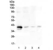 Western blot testing of 1) human placenta, 2) human SGC-7901, 3) rat lung and 4) mouse lung lysate with RP2 antibody at 0.5ug/ml. Predicted molecular weight ~40 kDa.
