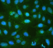Immunofluorescent staining of FFPE human U-2 OS cells with RP2 antibody (green) and DAPI nuclear stain (blue). HIER: boil tissue sections in pH6, 10mM citrate buffer, for 20 min and allow to cool before testing.
