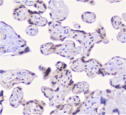 IHC staining of FFPE human placenta with Properdin antibody at 1ug/ml. HIER: boil tissue sections in pH6, 10mM citrate buffer, for 10-20 min followed by cooling at RT for 20 min.