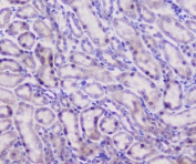 IHC staining of FFPE mouse kidney with Properdin antibody at 1ug/ml. HIER: boil tissue sections in pH6, 10mM citrate buffer, for 10-20 min followed by cooling at RT for 20 min.