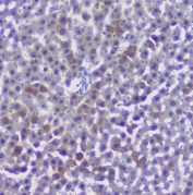 IHC staining of FFPE rat liver with Properdin antibody at 1ug/ml. HIER: boil tissue sections in pH6, 10mM citrate buffer, for 10-20 min followed by cooling at RT for 20 min.