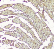 IHC staining of FFPE rat heart with CKM antibody at 1ug/ml. HIER: boil tissue sections in pH6, 10mM citrate buffer, for 10-20 min followed by cooling at RT for 20 min.