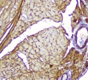 IHC staining of FFPE mouse heart with CKM antibody at 1ug/ml. HIER: boil tissue sections in pH6, 10mM citrate buffer, for 10-20 min followed by cooling at RT for 20 min.