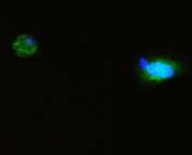 Immunofluorescent staining of human A431 cells with p62 antibody (green) at 2ug/ml. HIER: boil tissue sections in pH6, 10mM citrate buffer, for 10-20 min and allow to cool before testing.