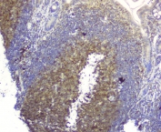 IHC testing of FFPE mouse small intestine with p62 antibody. HIER: Boil the paraffin sections in pH 6, 10mM citrate buffer for 20 minutes and allow to cool prior to staining.