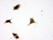 Immunocytochemical staining of human A549 cells with p62 antibody at 1ug/ml.