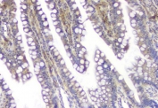 IHC testing of FFPE rat small intestine with p62 antibody. HIER: Boil the paraffin sections in pH 6, 10mM citrate buffer for 20 minutes and allow to cool prior to staining.