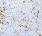 IHC testing of frozen human placental tissue with p62 antibody.