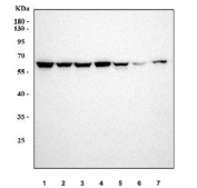 Western blot testing of 1) human HeLa, 2) human 293T, 3) human MCF7, 4) human Jurkat, 5) rat liver, 6) rat brain and 7) mouse liver tissue lysate with p62 antibody. Expected molecular weight: 47-62 kDa.