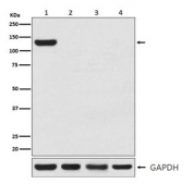 Western blot testing of CRISPR-Cas9 expression in 1) human 293T cell lysate transfected with CRISPR-Cas9, 2) human HEK293, 3) mouse NIH3T3 cell lysate and 4) rat PC12 cell lysate with CRISPR-Cas9 antibody.