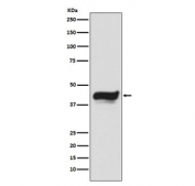 Western blot testing of human HeLa cell lysate with IKB epsilon antibody. Expected molecular weight: 38-53 kDa.