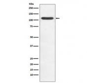 Western blot testing of human Jurkat cell lysate with HIP1 antibody. Predicted molecular weight ~116 kDa.