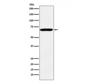 Western blot testing of human HeLa cell lysate with IGF2BP3 antibody. Predicted molecular weight ~64 kDa.