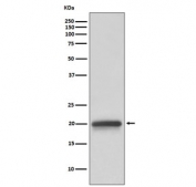 Western blot testing of human fetal brain lysate with Claudin 5 antibody. Predicted molecular weight ~23 kDa.