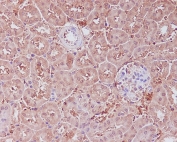 IHC staining of FFPE mouse kidney tissue with APAF1 antibody. HIER: boil tissue sections in pH6, 10mM citrate buffer, for 10-20 min and allow to cool before testing.