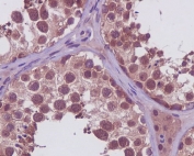 IHC staining of FFPE human testis tissue with PRMT5 antibody. HIER: boil tissue sections in pH6, 10mM citrate buffer, for 10-20 min and allow to cool before testing.