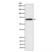 Western blot testing of human HeLa cell lysate with PRMT5 antibody. Expected molecular weight ~72 kDa.