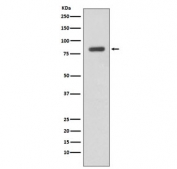 Western blot testing of human Daudi cell lysate with IKK beta antibody. Predicted molecular weight ~87 kDa.