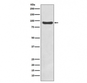 Western blot testing of human HeLa cell lysate with IKKb antibody. Predicted molecular weight ~87 kDa.