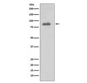 Western blot testing of human Daudi cell lysate with IKK alpha antibody. Predicted molecular weight ~85 kDa.