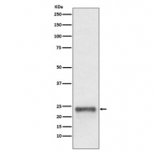 Western blot testing of human HepG2 cell lysate with Ubiquitin D antibody. Expected molecular weight: 18-22 kDa.